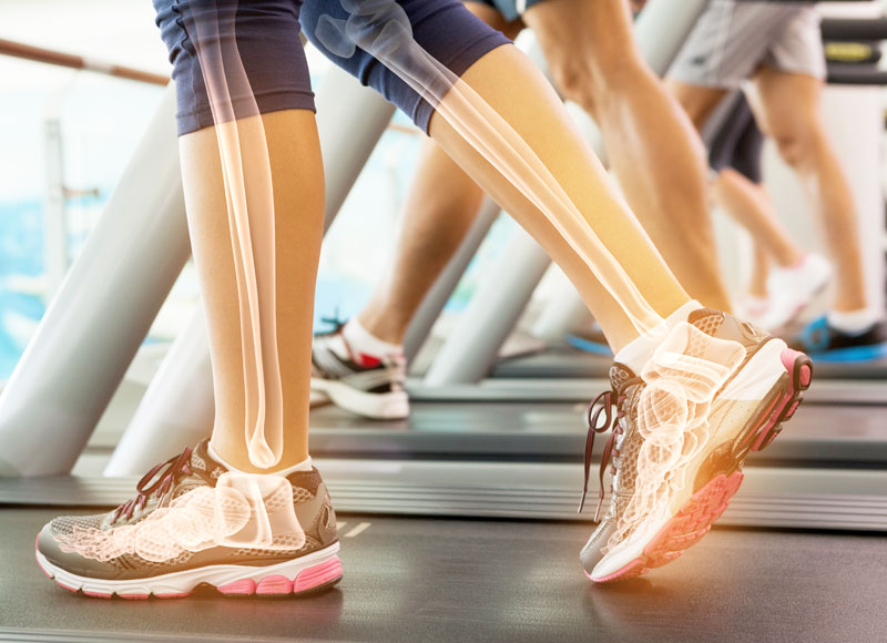 Image of a person on a treadmill with an an skeletal image super imposed